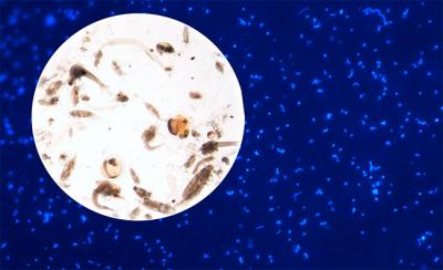 Las excreciones del zooplancton son una extraordinaria fuente de materia orgánica para las bacterias marinas