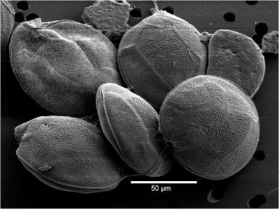Descubierta una nueva especie de microalga tóxica causante de ciguatera